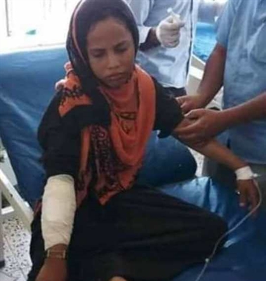 إصابة طفلة برصاص قناص حوثي غرب قعطبة بالضالع