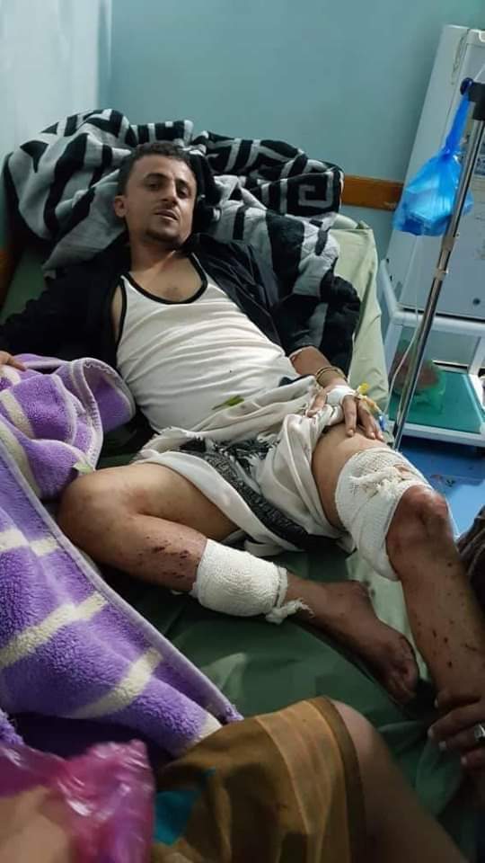 تعز.. إصابة مسؤل أمني بإشتباكات مع مطلوبين أمنيَّا