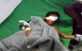 مقتل طفلة وإصابة جدها بقصف مدفعي للحوثيين في حجة