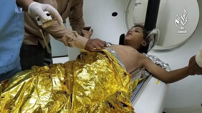 وفاة طفل وإصابة شقيقته و3 آخرين بقصف الحوثيين حي سكني بتعز