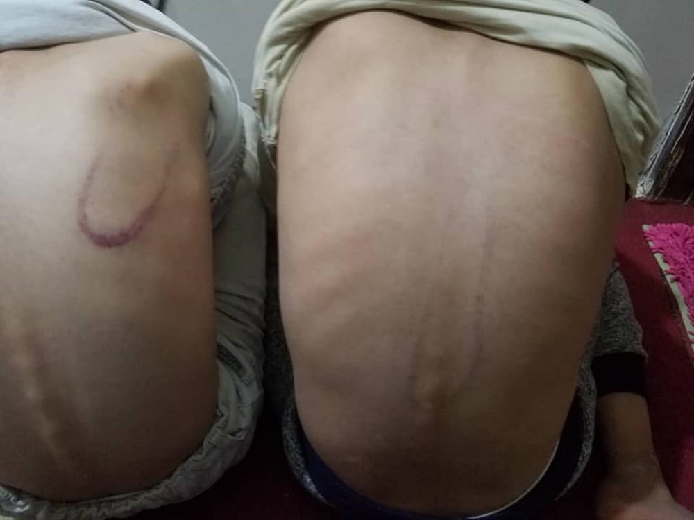 حوثيون يشجون رأس امرأة ويعتدون على أطفالها لإخراج الأسرة من الشقة في غياب الزوج