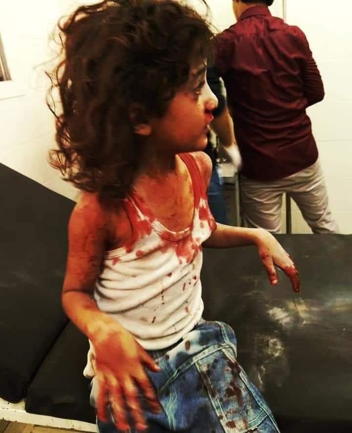إصابة أطفال بقصف صاروخي للحوثيين في مدينة تعز