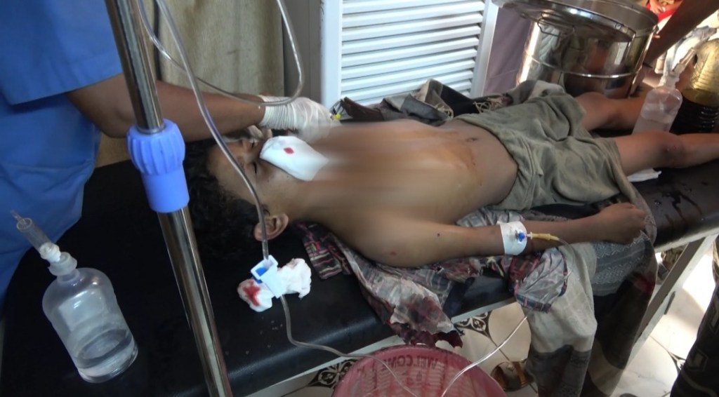 إصابة طفل في قصف مدفعي للحوثيين جنوب مدينة الحديدة 