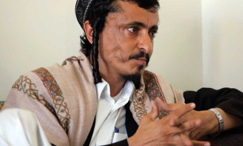 واشنطن تطالب الحوثيين بالافراج عن " يهودي يمني" 