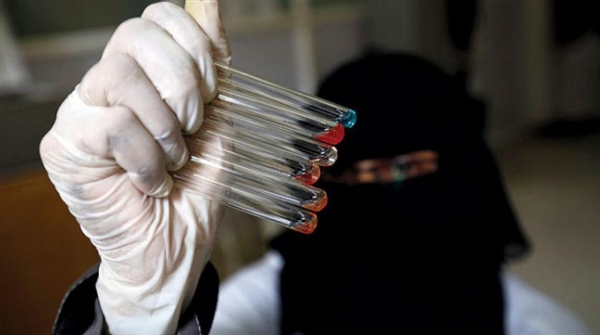 تسجيل 35 إصابة بفيروس كورونا بمديرية النادرة شرق إب