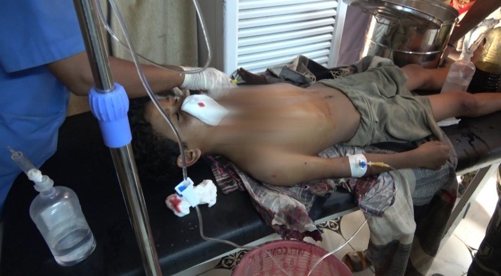 مقتل مواطن وإصابة آخر بقصف للحوثيين بالحديدة