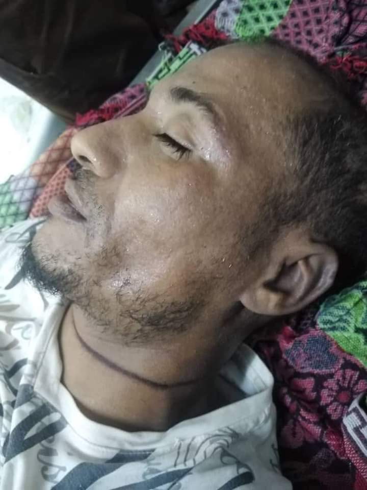 مسلحون يستقلون طقماً أمنياً يختطفون مالك لوكندة ويقتلونه شنقاً ويلقون جثته في الشارع بعدن