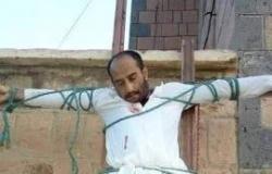 صورة مؤثرة لطبيب الاسنان المصلوب في البيضاء.. وتحذير من خطف جديد