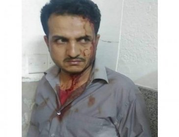 قيادي حوثي ومرافقيه يعتدون بالضرب المبرح على ممرض في مستشفى الثورة بصنعاء