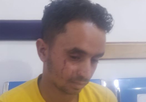 شاهد ..ضرب مبرح لنازح يبيع "البليلة" في شوارع إب يثير غضب رواد مواقع التواصل الإجتماعي(فيديو)