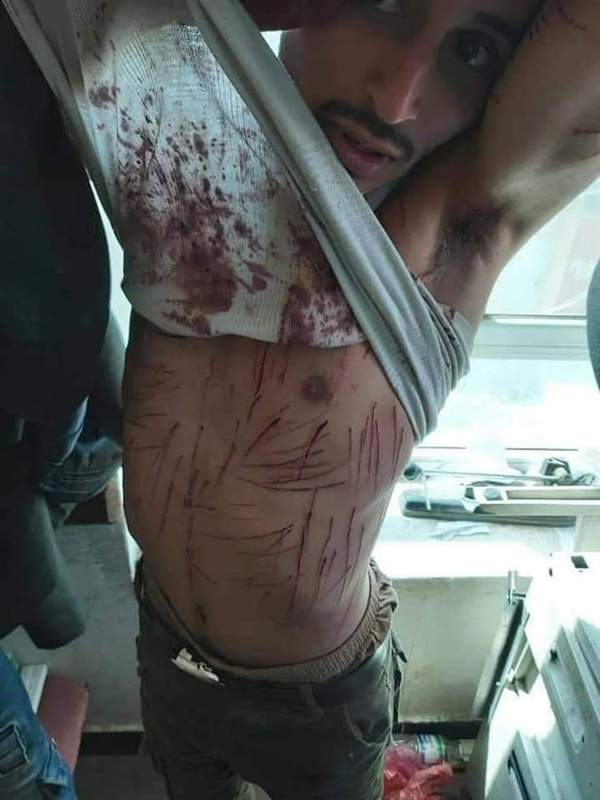 رايتس رادار تدين تعذيب الحوثي لشاب مسجون لديها في إب وقتل امرأة ضربا في ذات المنطقة