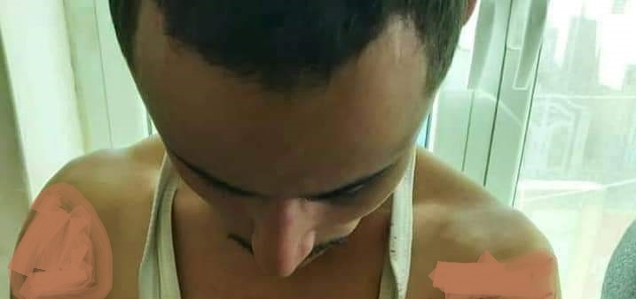 جريمة جديدة في العدين لشاب تعرض لعملية تعذيب مروعة في سجن حوثي