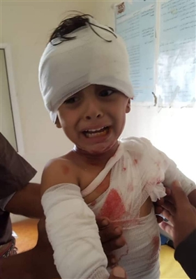 إصابة طفلين بشظايا قذيفة حوثية بالبيضاء