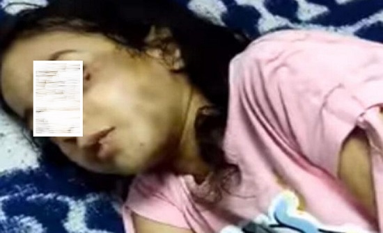 فيديو يهزّ القلوب .. هذا ما فعله أب “منزوع القلب” بابنته (شاهد)