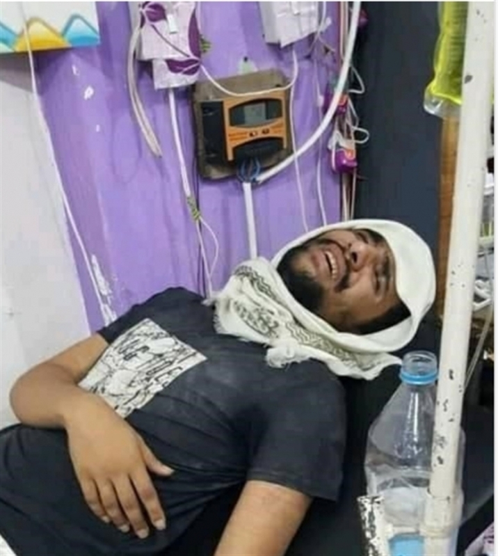 الحزام الأمني بلحج يطلق سراح المصور الصحفي "سويد" بحالة صحية سيئة